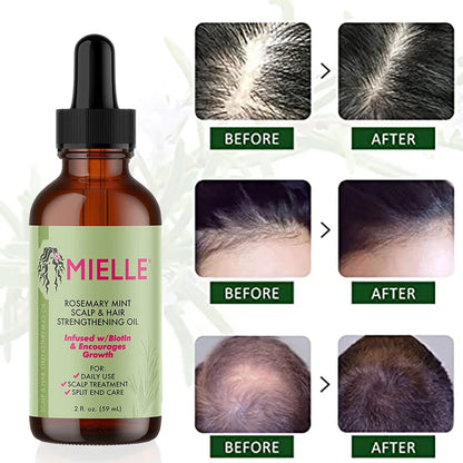 Rosemary Hair Growth Oil