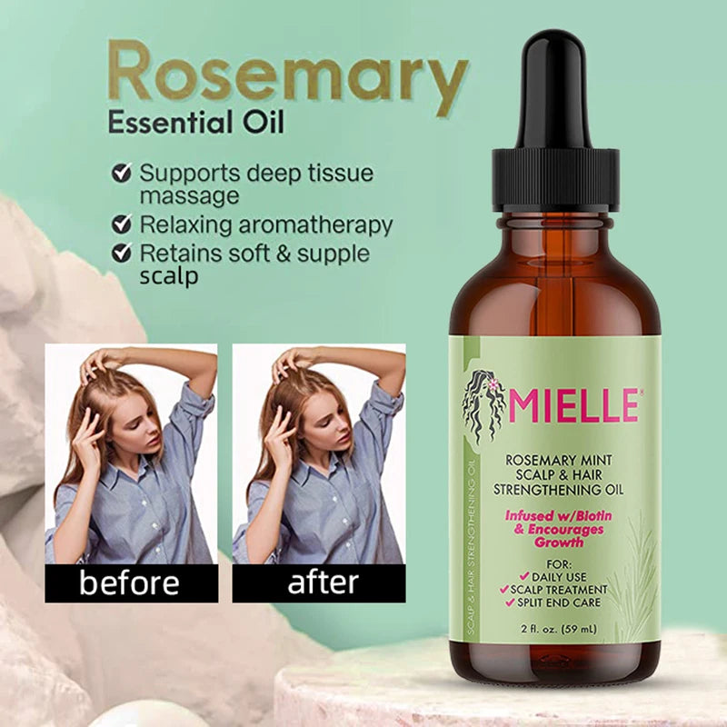 Rosemary Hair Growth Oil